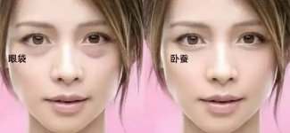 女人有眼袋显老？多吃这菜，赶跑黑眼圈！